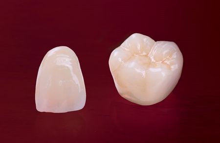 Dental Crowns